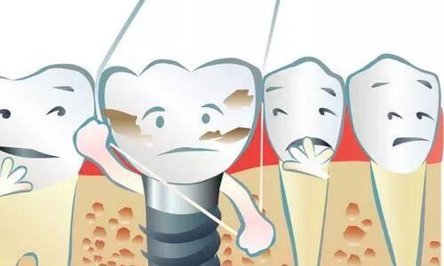 牙齿健康与身体健康息息相关